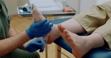 Specialist applying QUTENZA patch to foot.